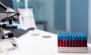Pruebas de laboratorio en Escazú