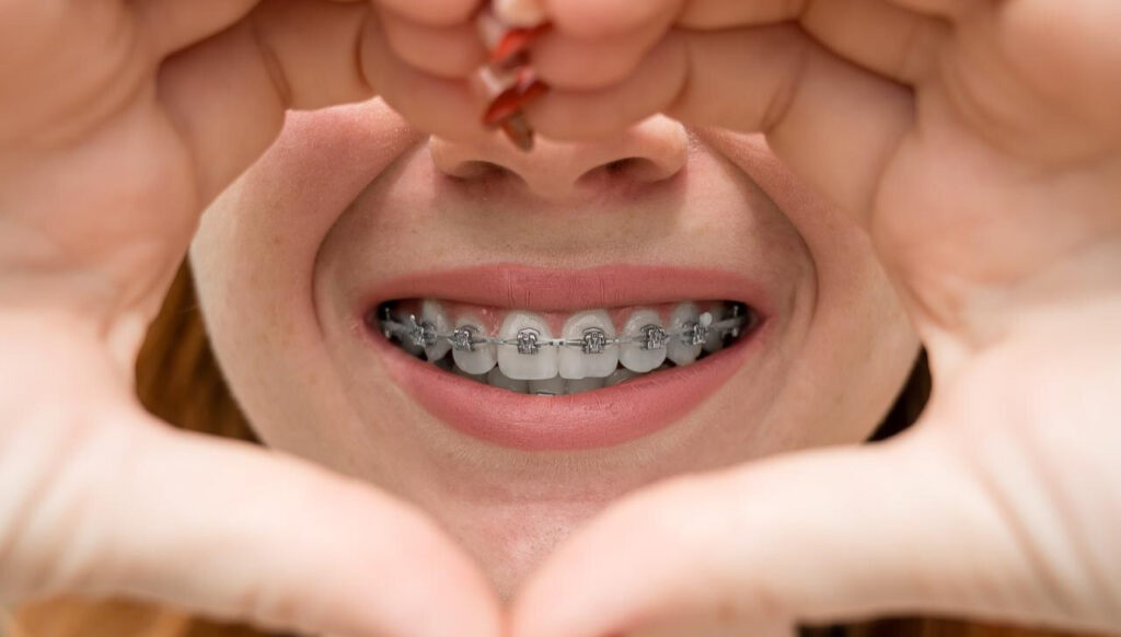 Ortodoncia-goodmed-costa-rica
