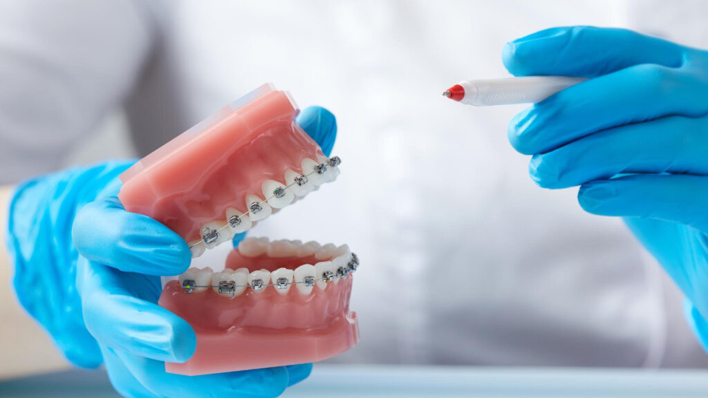 tratamientos ortodoncia sonrisa