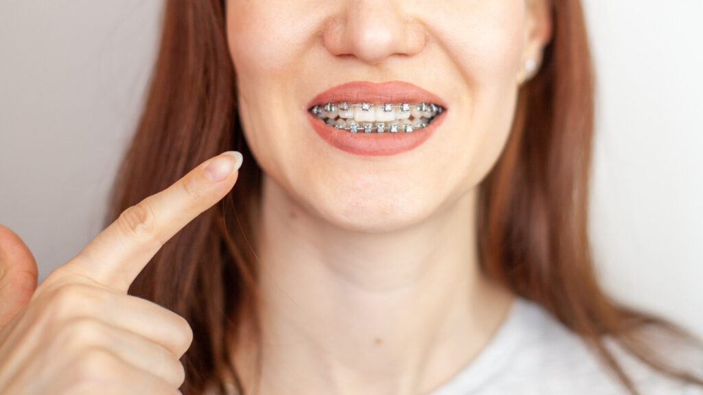tratamientos de ortodoncia